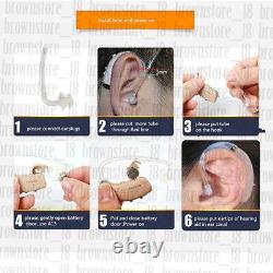 New Signi a RUN P Moderate Loss Behind-The-Ear Digital 70/132 dB BTE Hearing Aid
