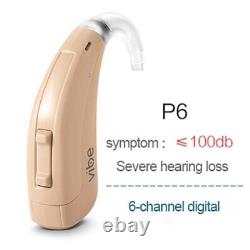 SIEMENS Vibe Hearing Aid Digital 4 6 8 Channels Original Chips Hearing Aids