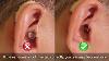 Video 4 Insertion And Removal Of Receiver In The Canal Ric Hearing Aids